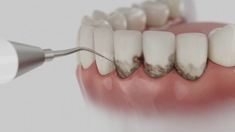 Reliable Dental contractor in Key Center, WA by Dentist Open Now